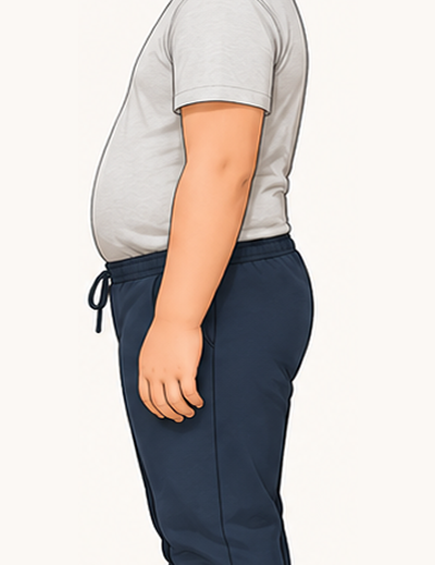 Tummy only, bottom and hips proportionate
